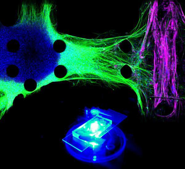 “芯片器官”：绿色部分为渐冻症患者诱导性多能干细胞分化而成的运动神经元，紫色部分为肌肉组织。