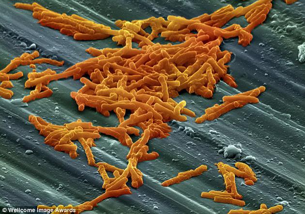 艰难梭菌是与临床长期使用某些抗生素引起的伪膜性结肠炎有关，因而引起医学界的重视。