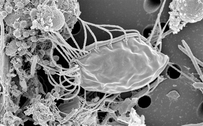 成排线状鞭毛导致新生物拥有“毛茸茸”的外观图片来源：趣味科学网