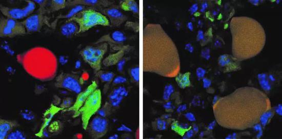  诱导前（左）肿瘤组织中的肿瘤细胞（绿）和脂肪细胞（红），以及诱导后（右）由肿瘤细胞分化成的脂肪细胞（红+绿形成暗黄色）