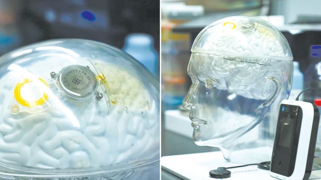 北京脑科学与类脑研究所研制的“北脑一号”脑机接口芯片（左）与植入后的效果示意模型（右）。（图源：CNN）